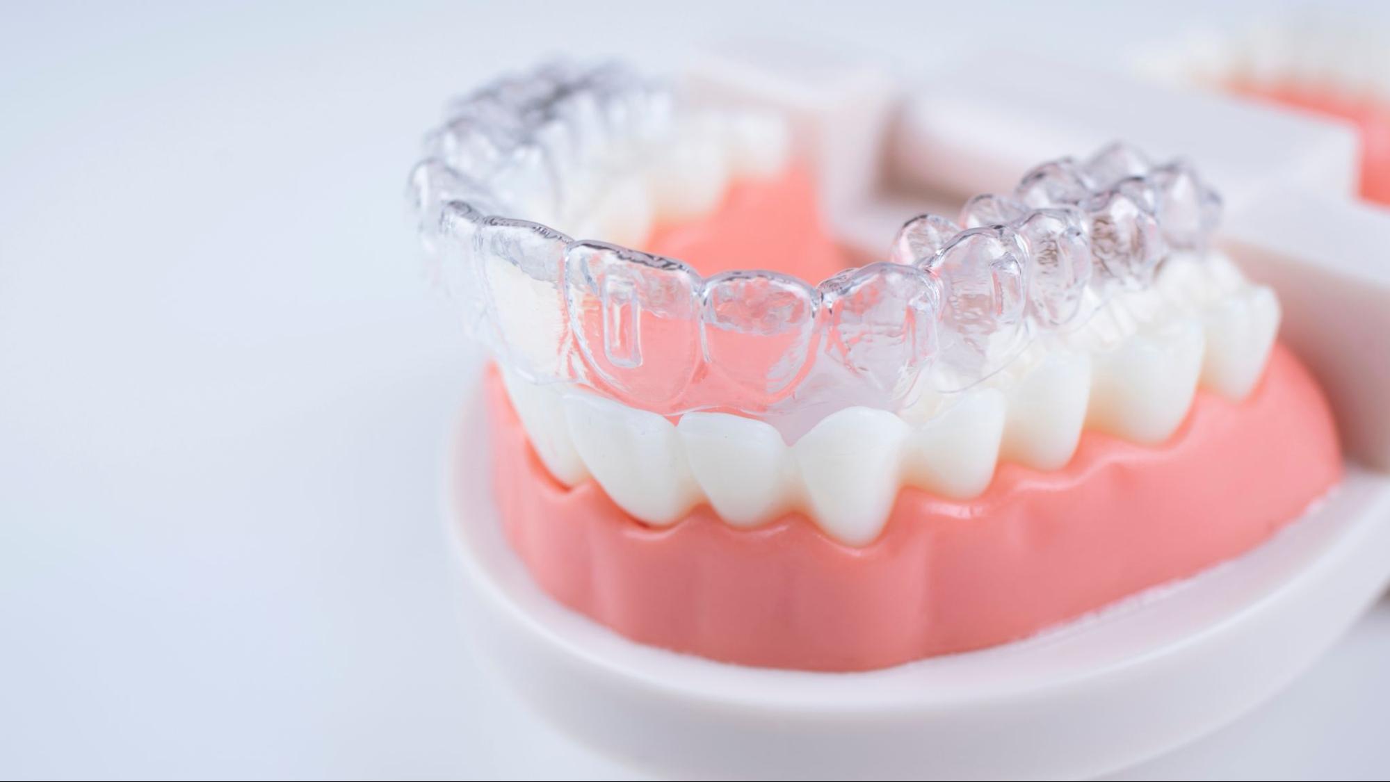 Understanding The Science Behind Invisalign